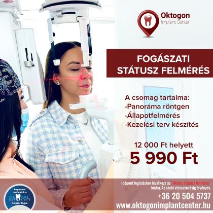 Státusz Felmérés AKCIÓ Státusz Felmérés AKCIÓ
