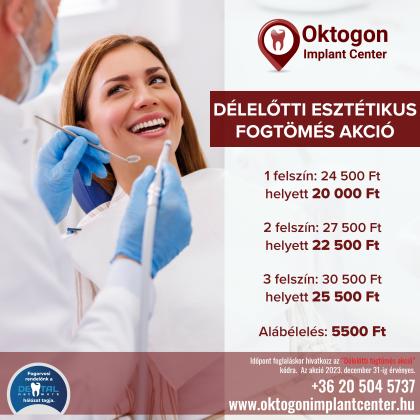 Délelőtti Esztétikus Fogtömés AKCIÓ Délelőtti Esztétikus Fogtömés AKCIÓ