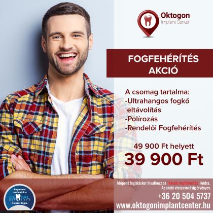 Fogfehérítés AKCIÓ