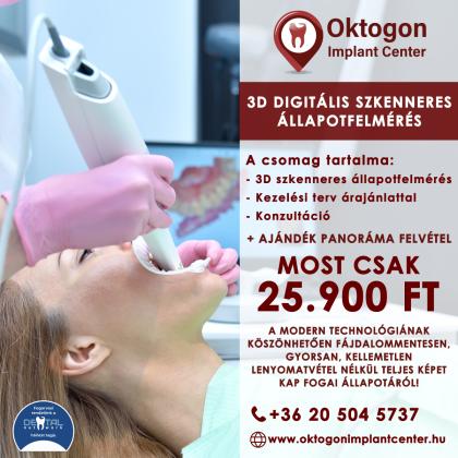 3D digitális állapotfelmérés 3D digitális állapotfelmérés