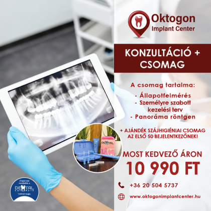 Konzultáció+ csomag