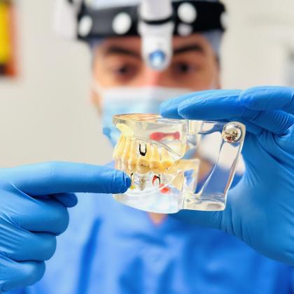 Implantátum beültetés elejétől a végéig – erre számíthat