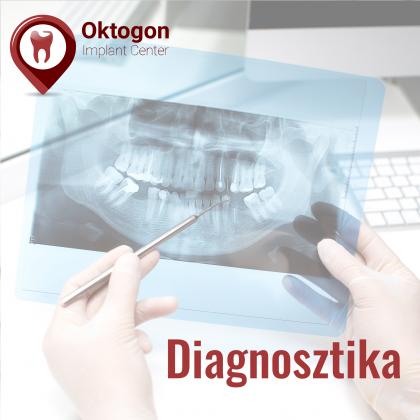 Diagnosztika - Minden a stabil alapoknál kezdődik