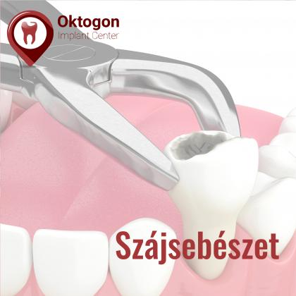 Oral surgery